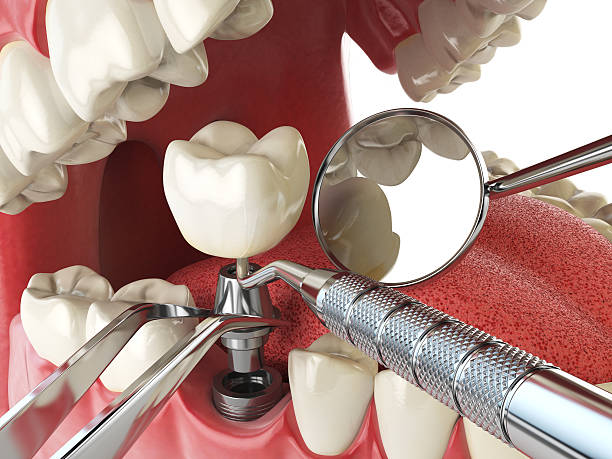 Best Emergency Dental Surgery in Blythewood, SC